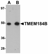 Anti-TMEM184B Antibody (C-Terminus) IHC-plus LS-B5089