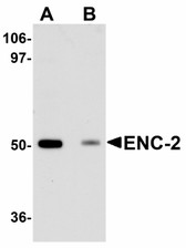 Anti-KLHL25 Antibody (Internal) IHC-plus LS-B5090