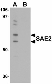 Anti-SAE2 / UBA2 Antibody (C-Terminus) IHC-plus LS-B5092