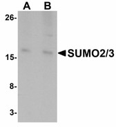 Anti-SUMO2 + SUMO3 Antibody (C-Terminus) IHC-plus LS-B5093