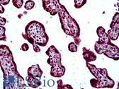 Anti-SH3KBP1 / CIN85 Antibody (aa2-14) IHC-plus LS-B5096