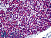 Anti-AP3B1 Antibody (aa2-14) IHC-plus LS-B5108