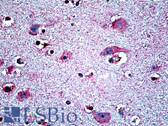 Anti-NTN1 / Netrin 1 Antibody (aa498-509) IHC-plus LS-B5109