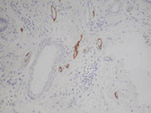 Rat anti Podoplanin 1:800 stained on human skin by Polink-2 Plus HRP Rat-NM DAB kit (Cat. No. D46-18)