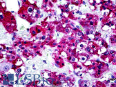 Anti-PTPN22 / PEP Antibody (aa766-780) IHC-plus LS-B5113