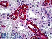 Anti-CFTR Antibody (aa2-14) IHC-plus LS-B5115