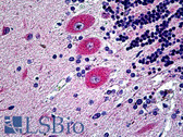 Anti-HEP / EPHB6 Antibody (aa831-843) IHC-plus LS-B5134