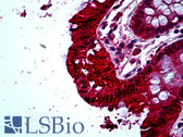 Anti-TAB2 Antibody (aa79-90) IHC-plus LS-B5139