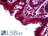 Anti-TAB2 Antibody (aa161-173) IHC-plus LS-B5140