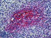 Anti-CR2 / CD21 Antibody (clone 2G9) IHC-plus LS-B5145