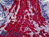 Anti-Muscle Actin Antibody (clone MSA06) IHC-plus LS-B5151