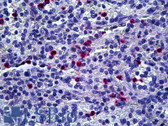 Anti-Macrophage Antibody (clone MAC387) IHC-plus LS-B5158