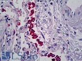 Anti-SFTPB / Surfactant Protein B Antibody (clone SPB01) IHC-plus LS-B5172