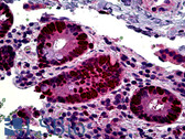 Anti-MKI67 / Ki67 Antibody (Internal) IHC-plus LS-B5180