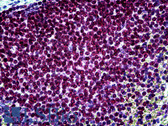 Anti-PARP1 Antibody IHC-plus LS-B5181