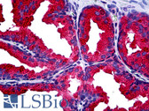 Anti-MMP13 Antibody IHC-plus LS-B5183