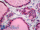 Anti-CLDN7 / Claudin 7 Antibody (C-Terminus) IHC-plus LS-B5188