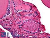 Anti-TG / Thyroglobulin Antibody (clone SPM517) IHC-plus LS-B5195