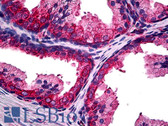 Anti-GCLC Antibody (Internal) IHC-plus LS-B5196