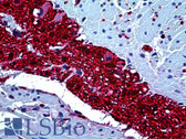 Anti-S100A6 Antibody IHC-plus LS-B5204