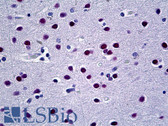 Anti-UBR5 Antibody (aa600-650) IHC-plus LS-B5219