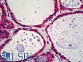Anti-CALR / Calreticulin Antibody IHC-plus LS-B5223