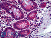 Anti-C-TAK1 / MARK3 Antibody IHC-plus LS-B5226