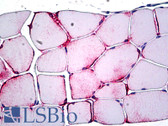 Anti-PPP1R13L / iASPP Antibody (aa75-125) IHC-plus LS-B5248