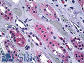 Anti-SPP1 / Osteopontin Antibody (Internal) IHC-plus LS-B5272