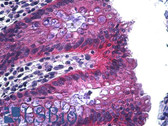 Anti-JUP/CTNNG/Junction Plakoglobin Antibody (C-Terminus) IHC-plus LS-B5281