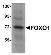 Anti-FOXO1 / FKHR Antibody (N-Terminus) IHC-plus LS-B5283