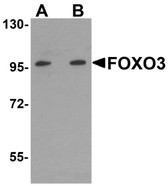 Anti-FOXO3 / FOXO3A Antibody (N-Terminus) IHC-plus LS-B5284