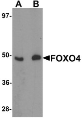 Anti-FOXO4 / AFX1 Antibody (N-Terminus) IHC-plus LS-B5285