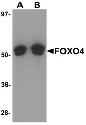Anti-FOXO4 / AFX1 Antibody (N-Terminus) IHC-plus LS-B5287