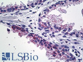 Anti-MMP23B Antibody (C-Terminus) IHC-plus LS-B5292
