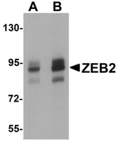 Anti-ZEB2 Antibody (C-Terminus) IHC-plus LS-B5294