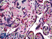 Anti-RBX1 / ROC1 Antibody (C-Terminus) IHC-plus LS-B5298