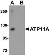 Anti-ATP11A Antibody (N-Terminus) IHC-plus LS-B5310