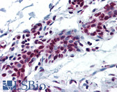 Anti-MYB / c-Myb Antibody (aa1-50) IHC-plus LS-B5315