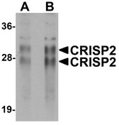 Anti-CRISP2 / TSP1 Antibody (N-Terminus) IHC-plus LS-B5318