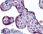 Anti-PTHR / PTHR1 Antibody (aa145-194) IHC-plus LS-B5322