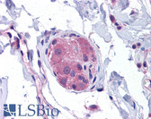 Anti-NOD1 Antibody (C-Terminus) IHC-plus LS-B5325
