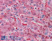 Anti-TFPI / LACI Antibody IHC-plus LS-B5333