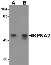 Anti-KPNA2 / Importin Alpha 1 Antibody (N-Terminus) IHC-plus LS-B5340