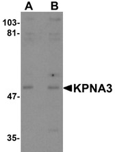 Anti-KPNA3 / Importin Alpha 4 Antibody (C-Terminus) IHC-plus LS-B5341