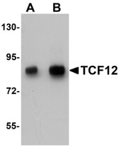 Anti-TCF12 / HEB Antibody (N-Terminus) IHC-plus LS-B5344