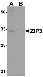 Anti-SLC39A3 / ZIP3 Antibody (Internal) IHC-plus LS-B5354