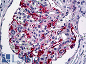 Anti-VHL / Von Hippel Lindau Antibody (aa34-83) IHC-plus LS-B5361
