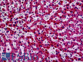 Anti-PIK3CA / PI3K Alpha Antibody (Internal) IHC-plus LS-B5363