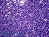 Anti-CD58 Antibody (clone 2D11-B10) IHC-plus LS-B5386